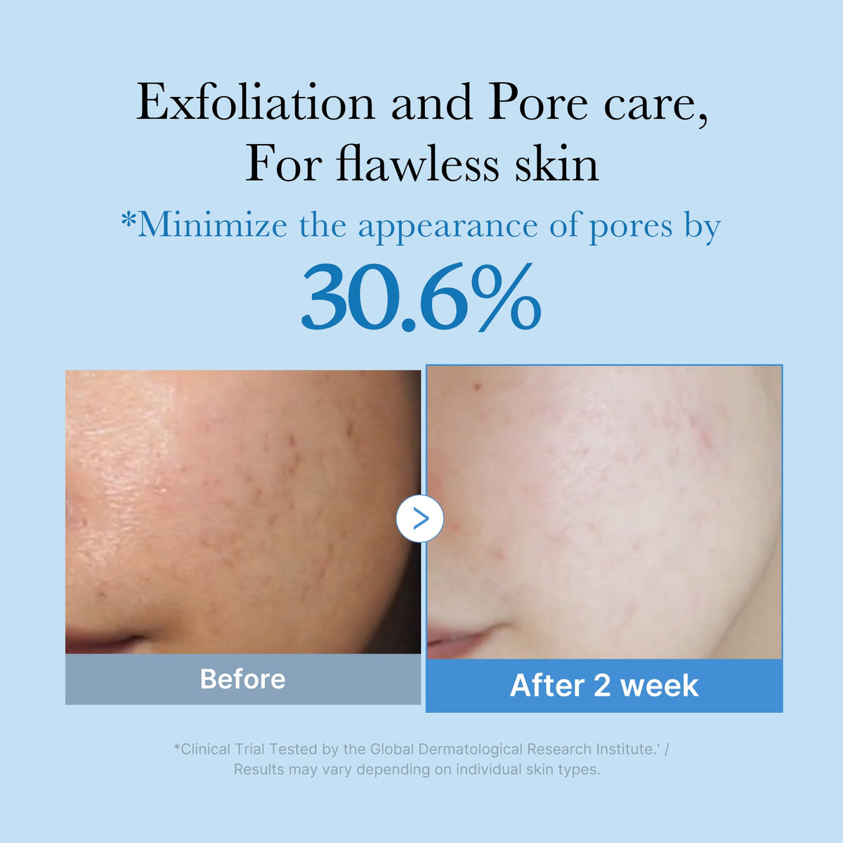 Medicube Zero Pore Toner — official gallery image 2