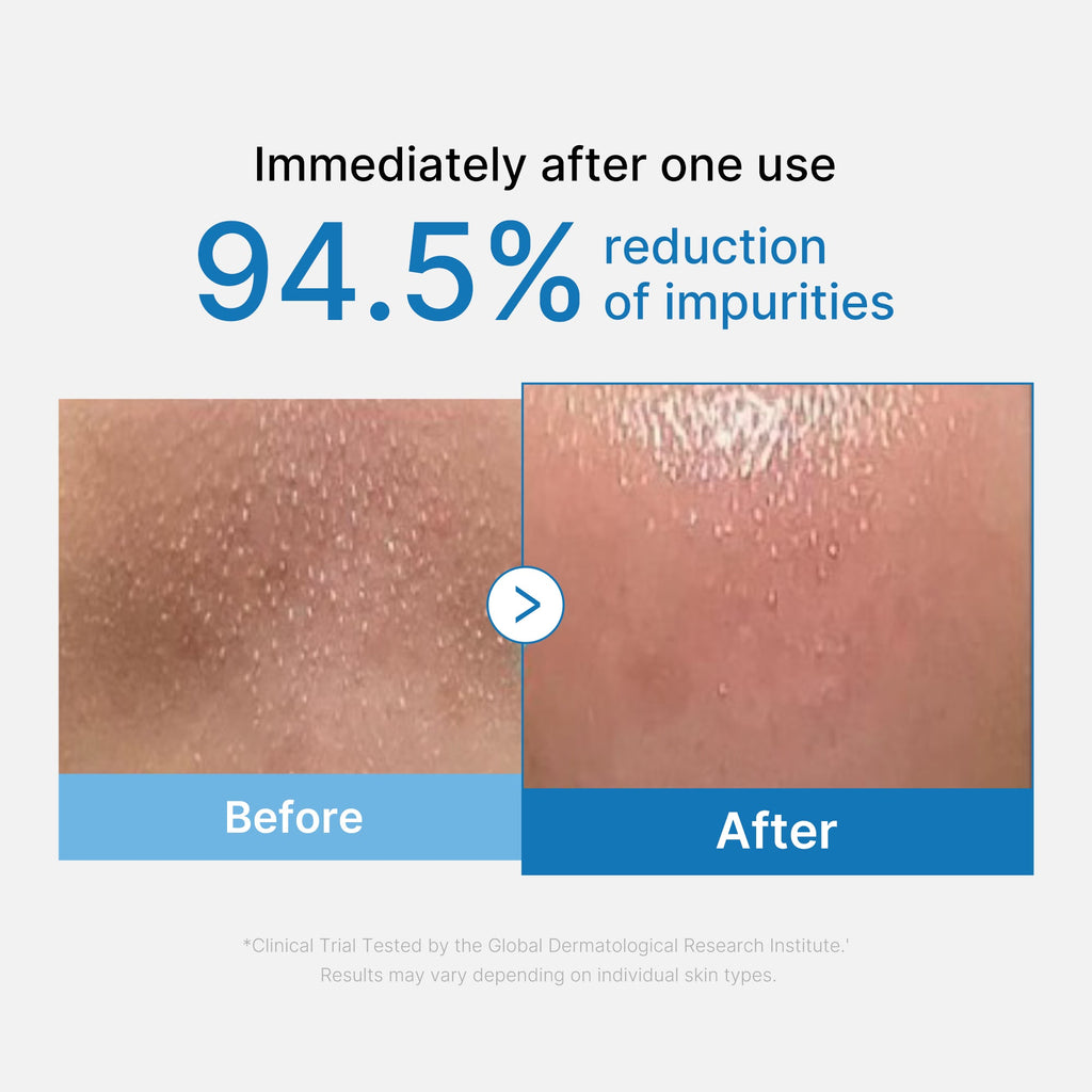 Medicube Zero Pore Blackhead Deep Cleansing Oil — official gallery image 2