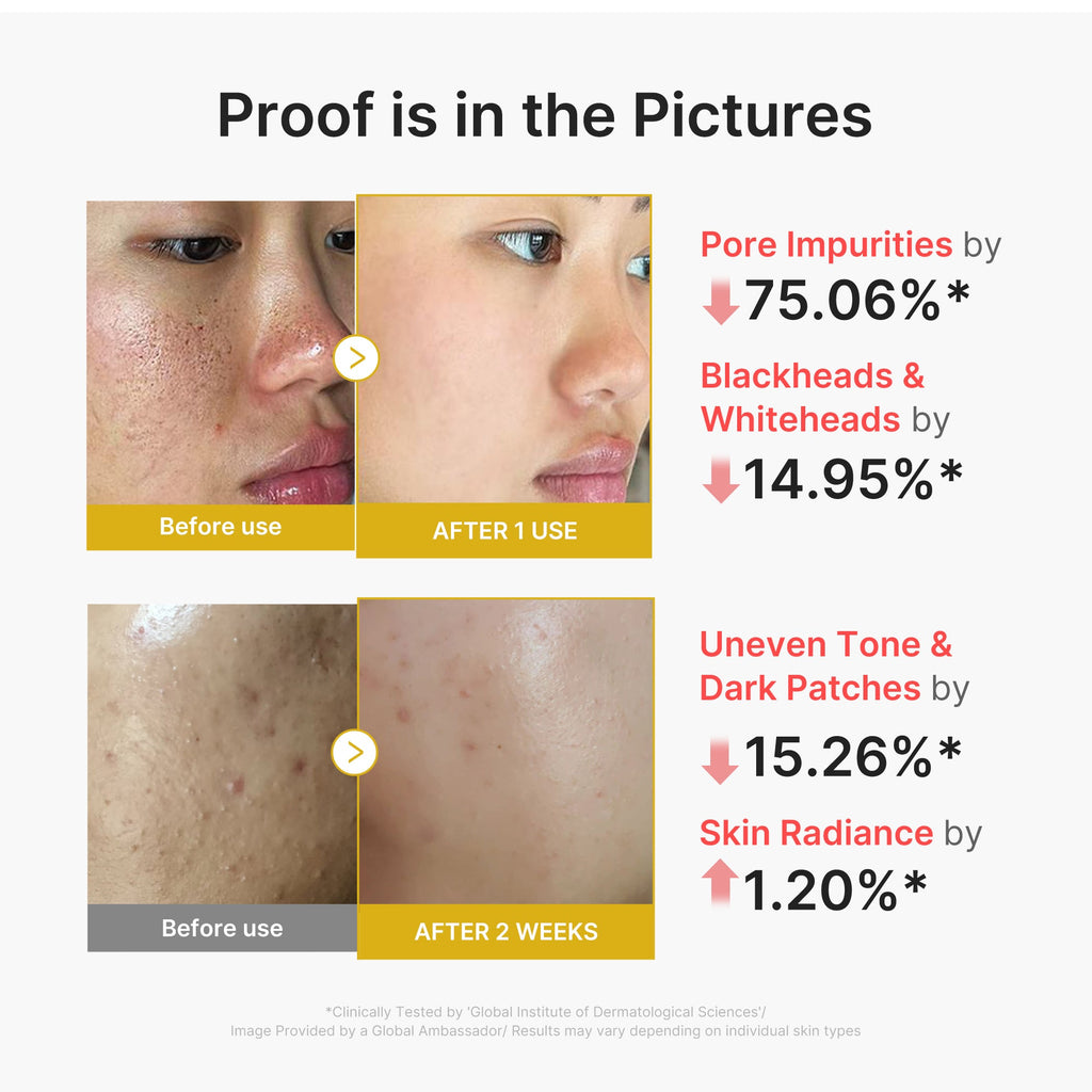 Medicube Kojic Acid Turmeric Peel Shot — official gallery image 3