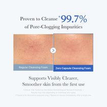 Medicube Zero Pore SA Clear Capsule Cleansing Foam — official gallery image 3