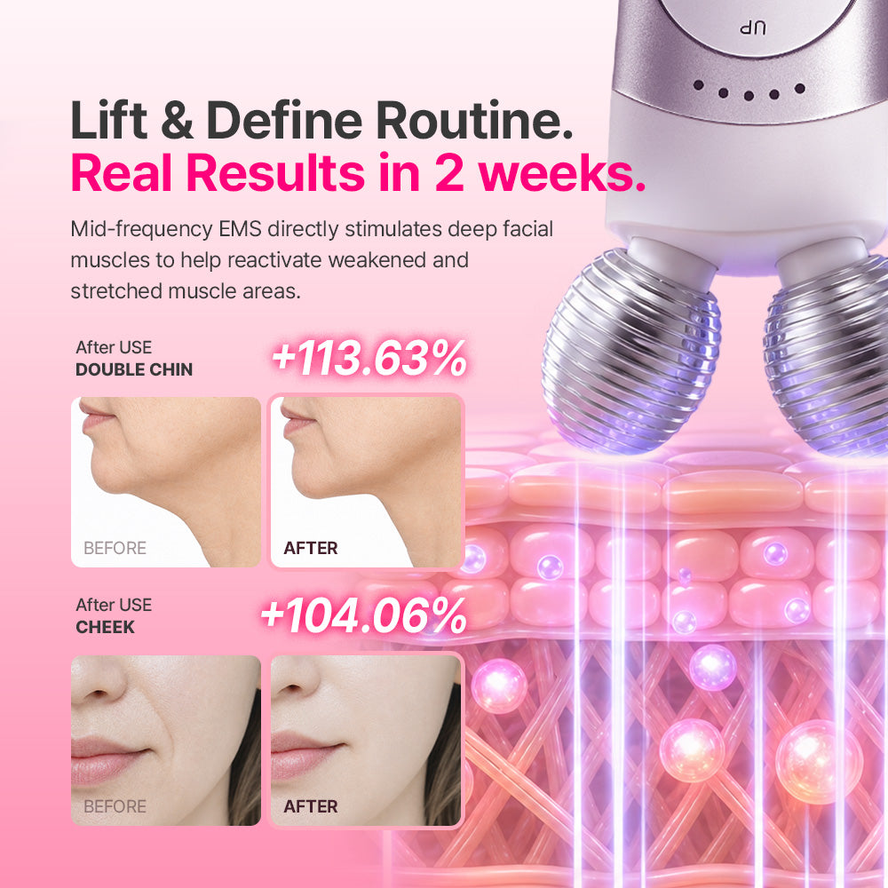 Mommy Care EMS V-THERA — White Edition — Product detail 3