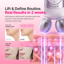 Mommy Care EMS V-THERA — White Edition — Product detail 3