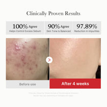 Medicube Red Succinic Acid Peeling Pad — official gallery image 4
