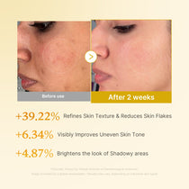 Medicube Kojic Acid Turmeric Resurfacing Toner — official gallery image 4