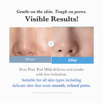 Medicube Zero Pore Pad Mild — official gallery image 4