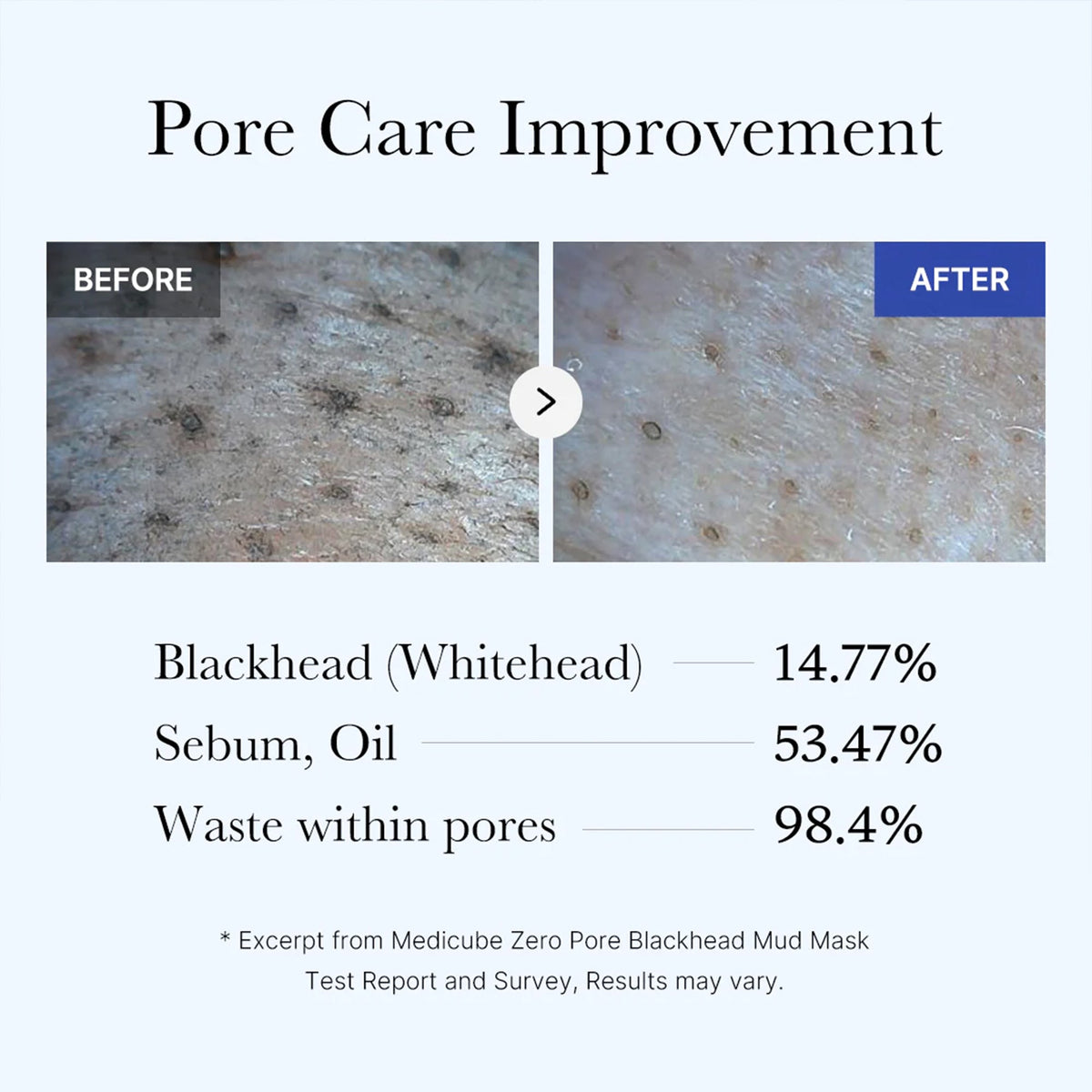 Medicube Zero Pore Blackhead Mud Mask — official gallery image 5