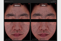 Medicube Zero Pore Pad 2.0 — official gallery image 8