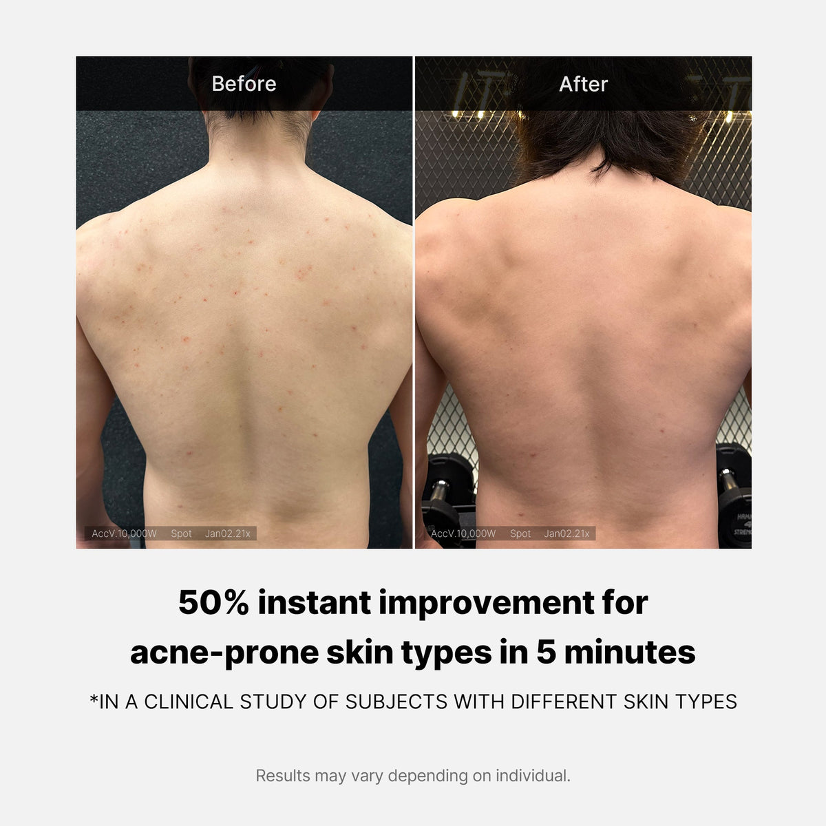 Medicube Red Acne Body Wash 2.0 — official gallery image 5