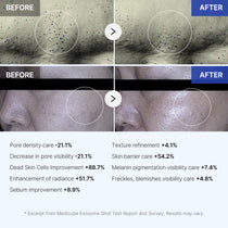 Medicube One Day Exosome Shot Pore Ampoule — official gallery image 12
