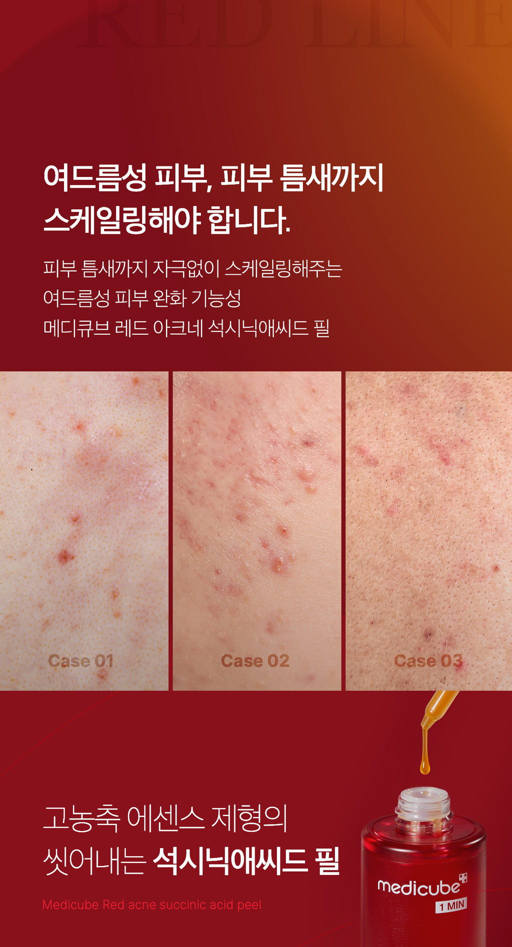 Medicube Red Acne Succinic Acid Peel — official gallery image 6