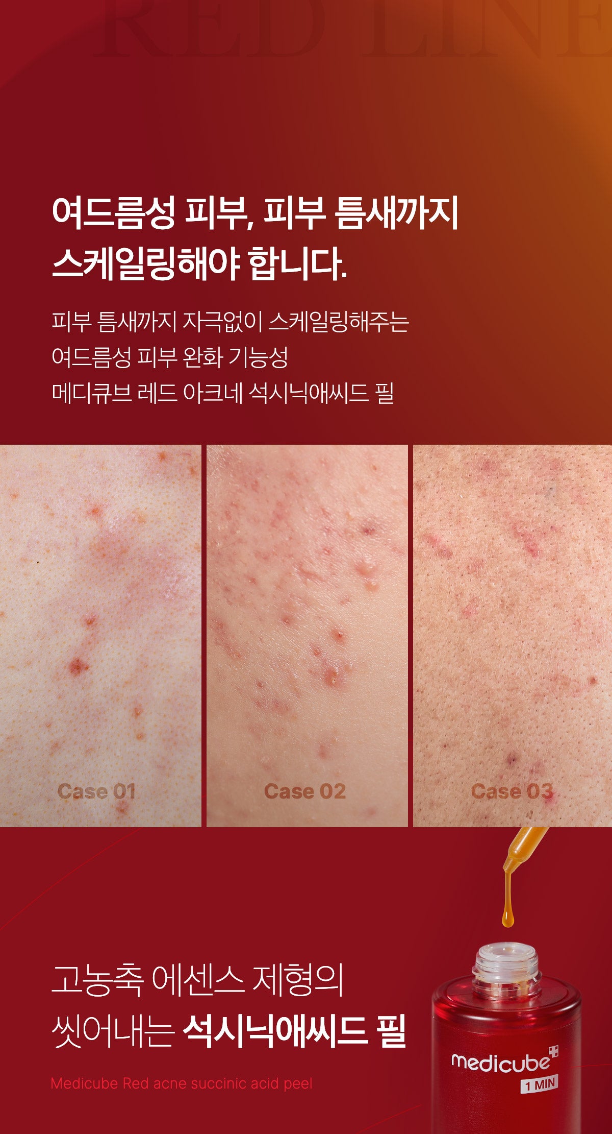 Medicube Red Acne Succinic Acid Peel — official gallery image 6
