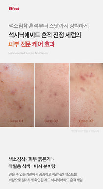 Medicube Red Succinic Acid Serum — official gallery image 7