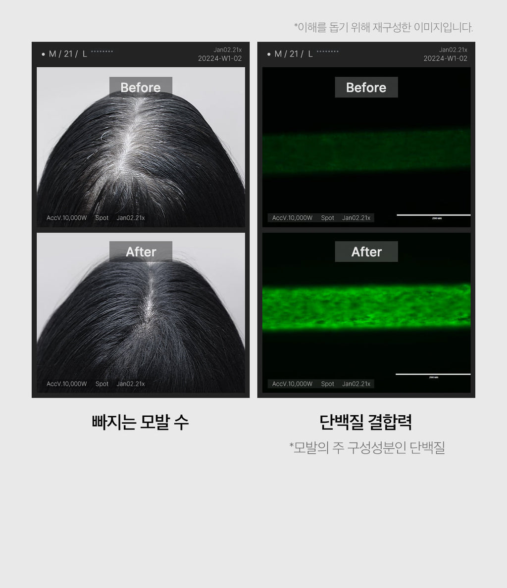 Medicube Soyxidil 2IN1 Treatment — official gallery image 4
