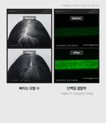 Medicube Soyxidil 2IN1 Treatment — official gallery image 4