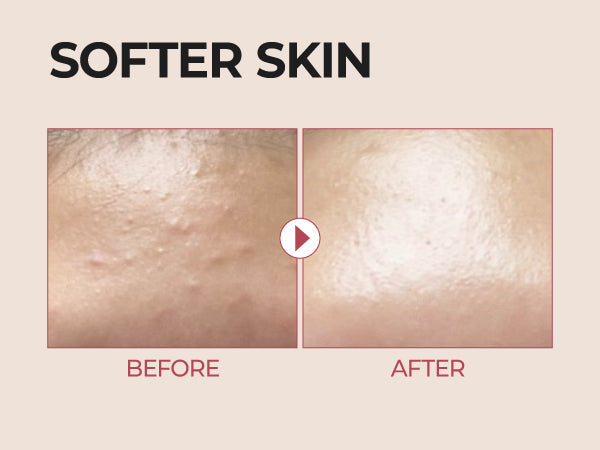 Numbuzin No.3 Skin Softening Serum — Product detail 16