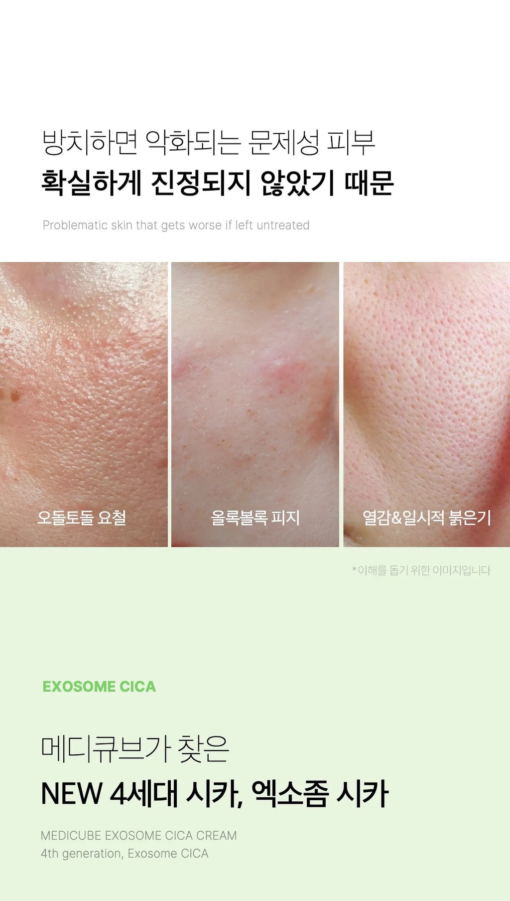 Medicube Exosome Cica Toner — official gallery image 9