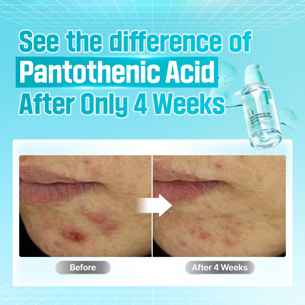 Numbuzin No.1 Pantothenic B5 Active Soothing Serum — Product detail 4