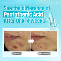 Numbuzin No.1 Pantothenic B5 Active Soothing Serum — Product detail 4