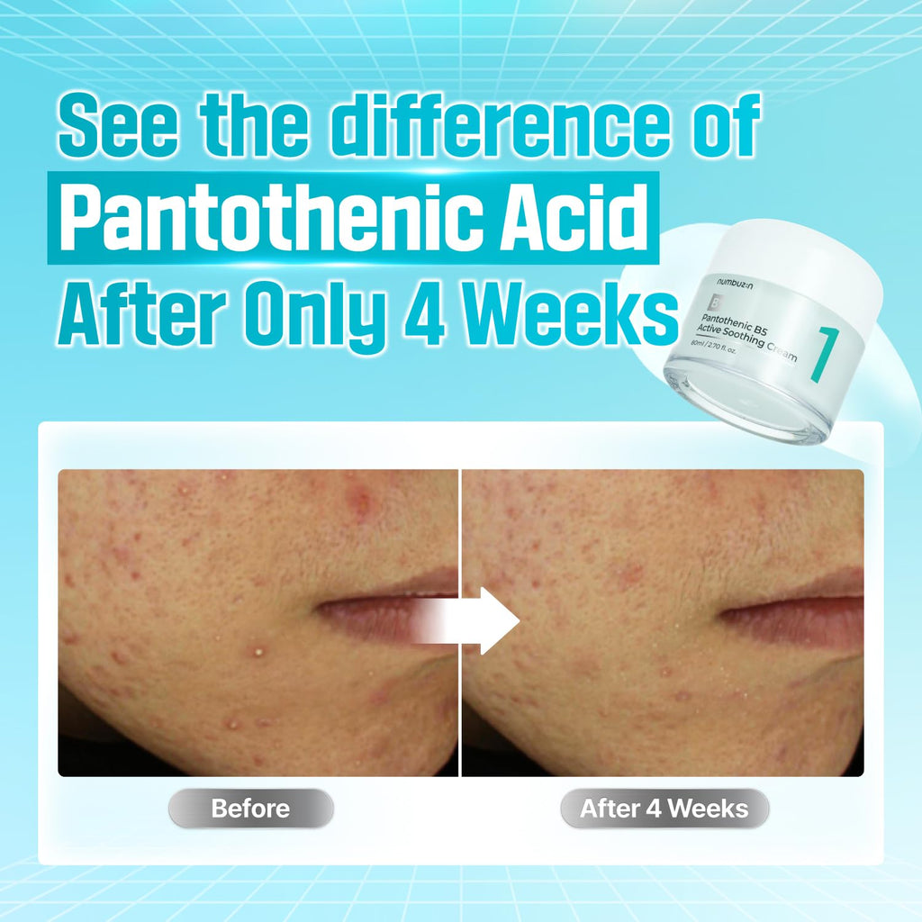 Numbuzin No.1 Pantothenic B5 Active Soothing Cream — Product detail 4