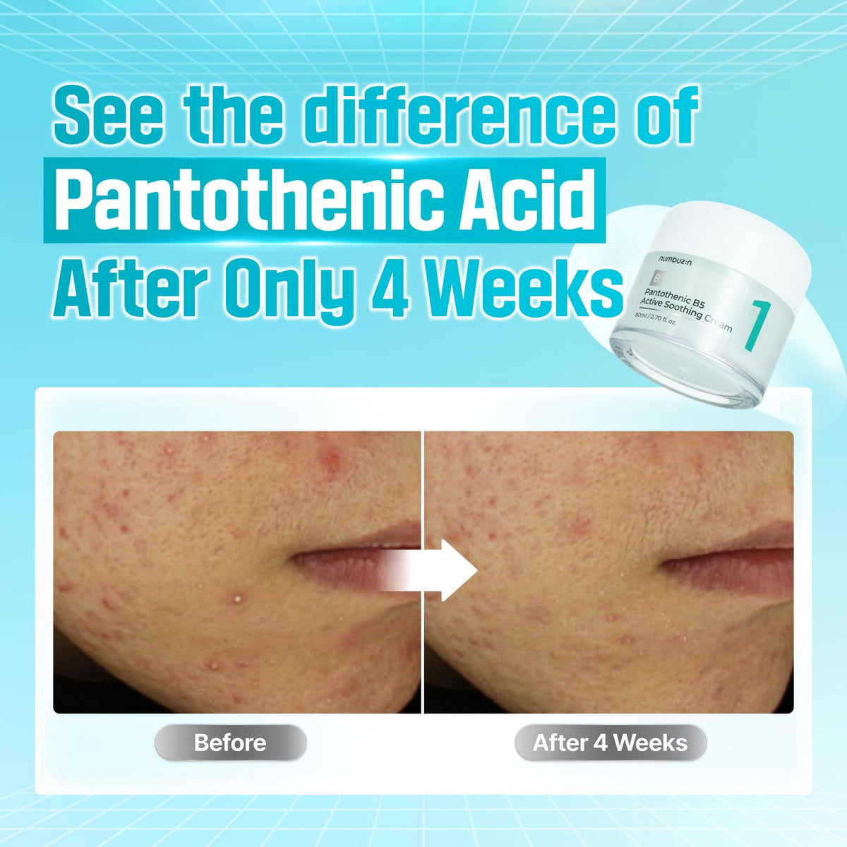 Numbuzin No.1 Pantothenic B5 Active Soothing Cream — Product detail 4