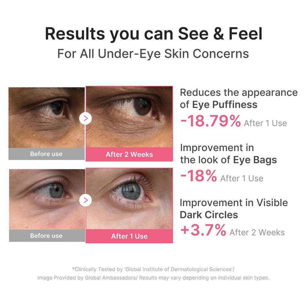 Medicube PDRN Caffeine Collagen Eye Patch — official gallery image 4