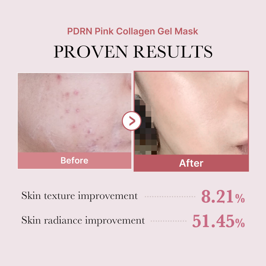 Medicube PDRN Pink Collagen Jelly Gel Mask — official gallery image 6