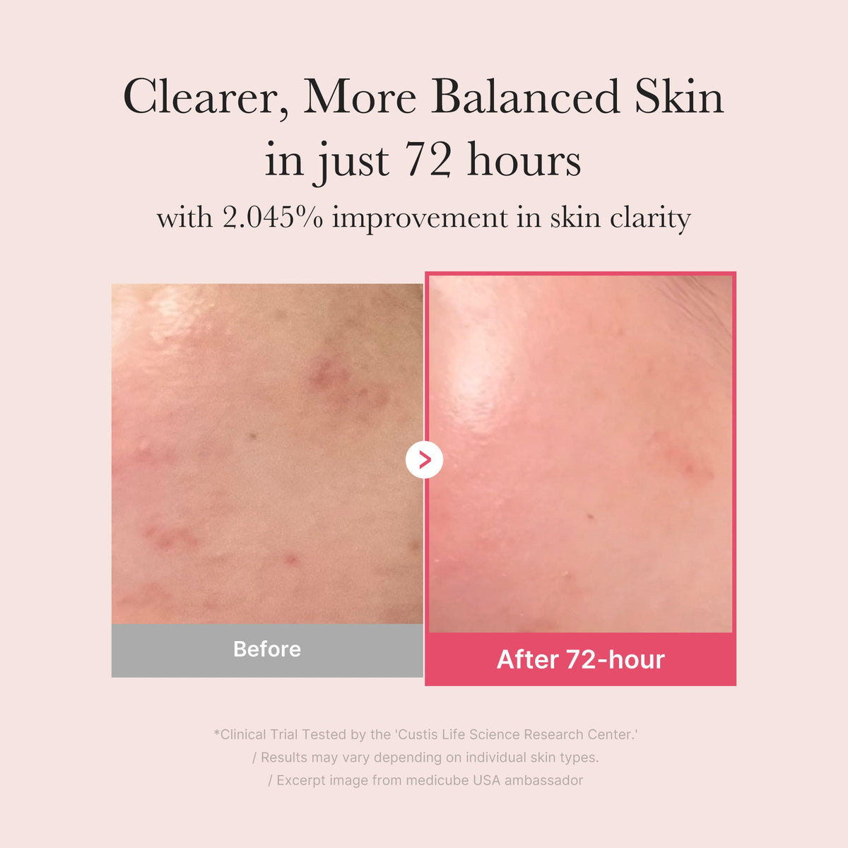 Medicube TXA Niacinamide 15% Serum — official gallery image 3