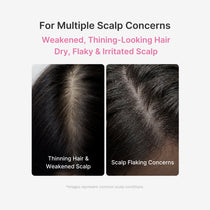 Medicube Rosemary PDRN Scalp Serum — official gallery image 3