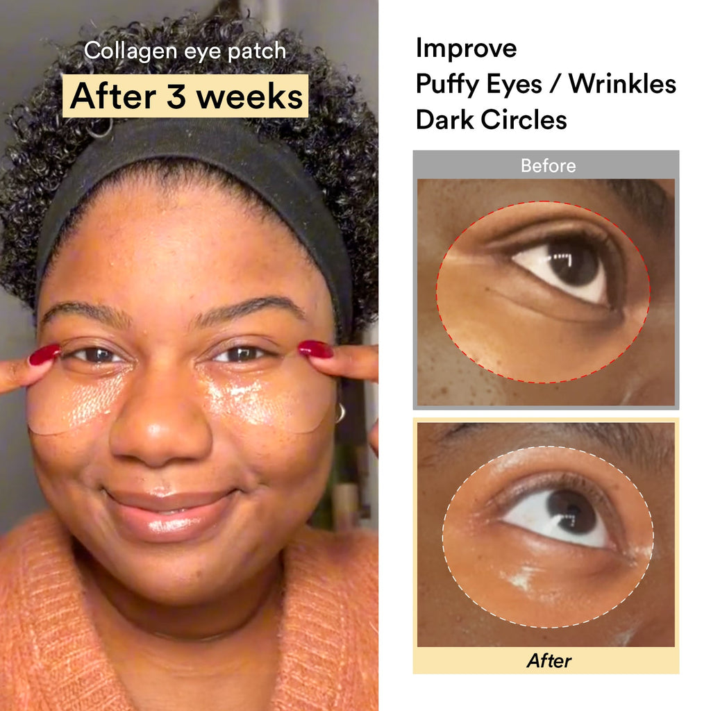 Abib Vegan Collagen Eye Patch Jericho Rose Jelly: before and after eye care images