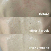 Medicube Red Acne Body Wash 2.0 — official gallery image 9