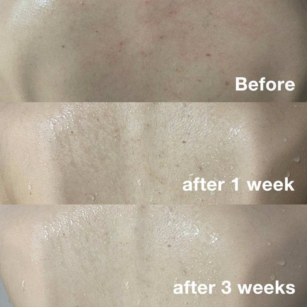 Medicube Red Acne Body Wash 2.0 — official gallery image 9