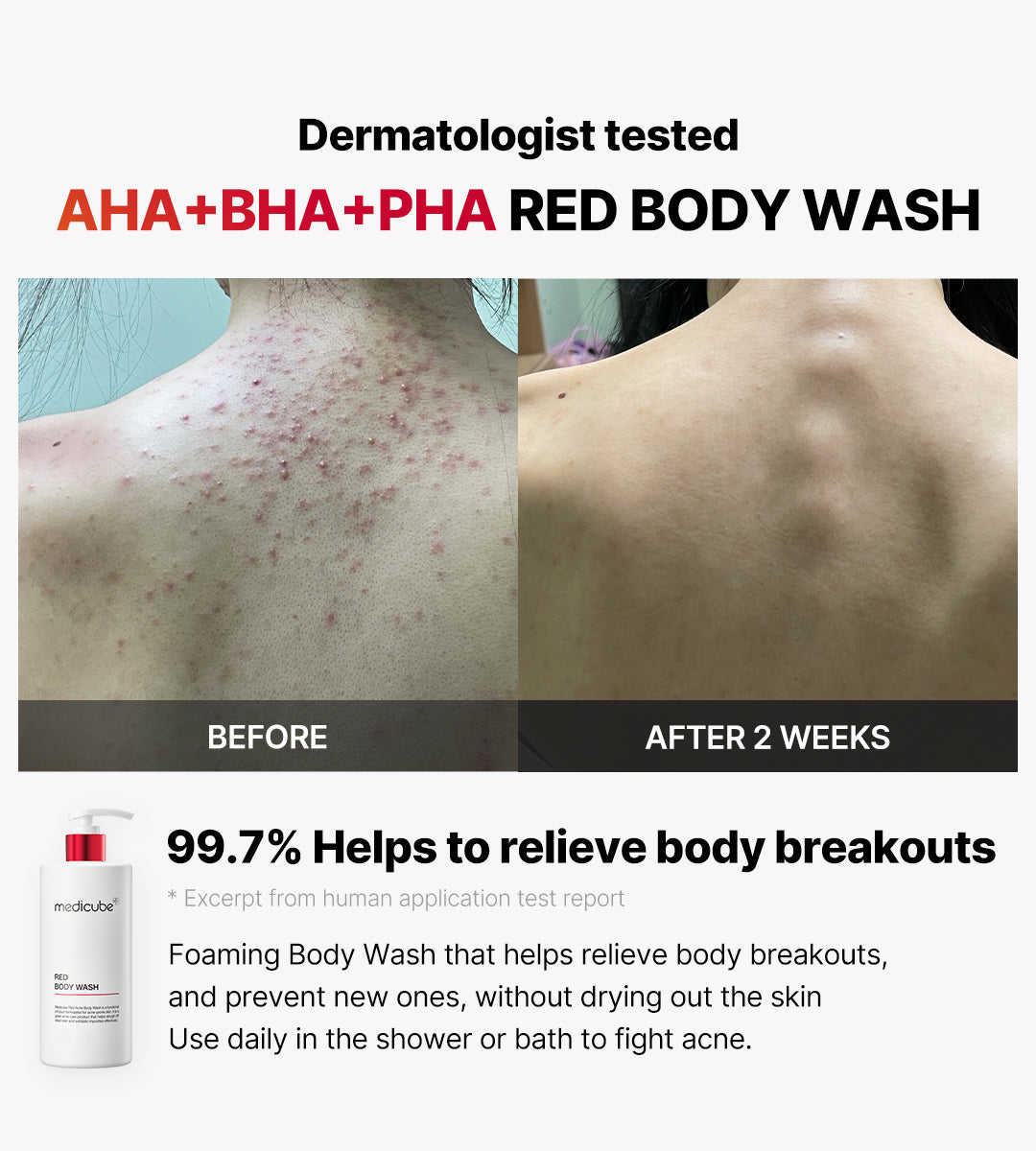 Medicube Red Acne Body Wash 2.0 — official gallery image 10