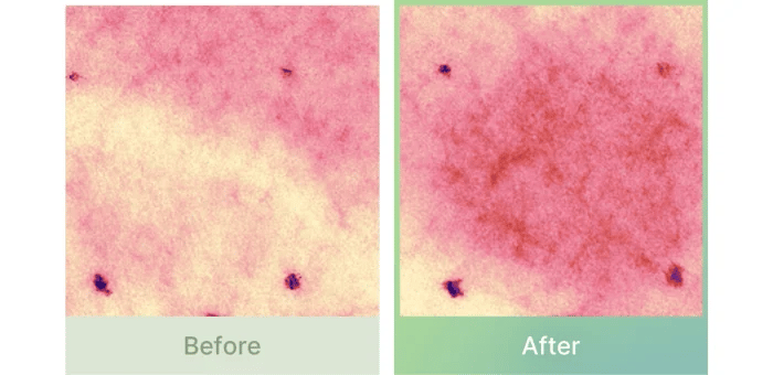 Medicube Exosome Cica Ampoule — official gallery image 21