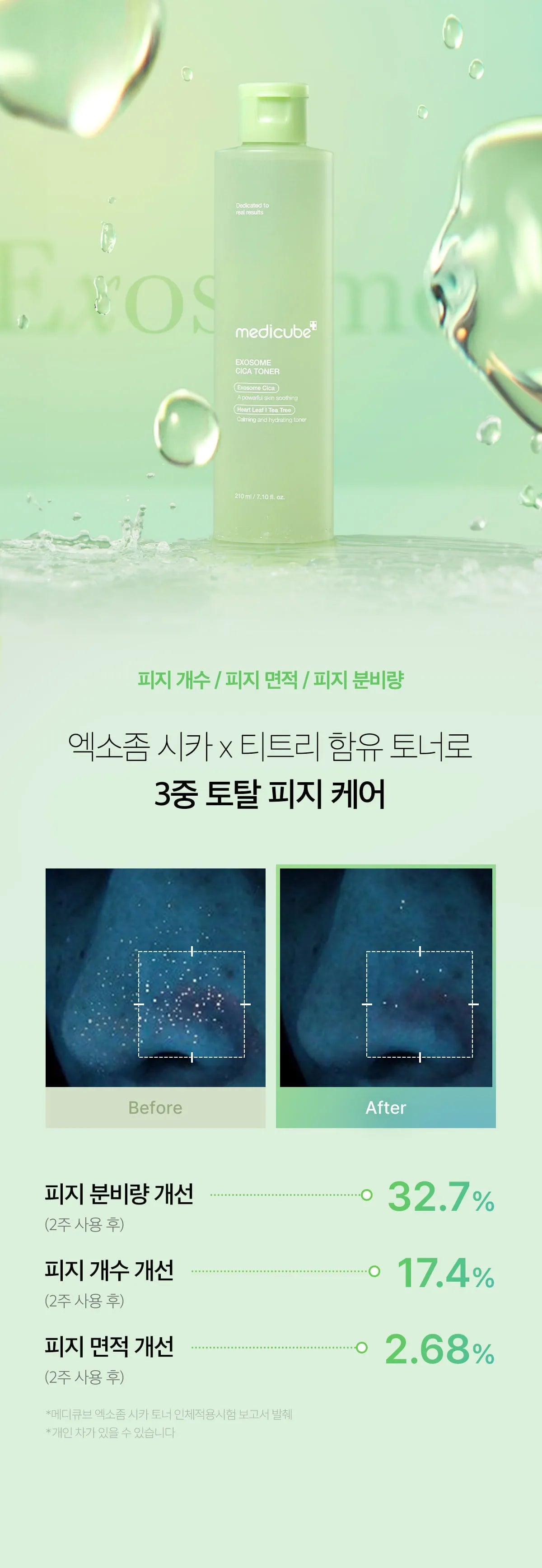 Medicube Exosome Cica Toner — official gallery image 21