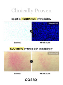 COSRX Advanced Snail Mucin Glass Glow Hydrogel Mask - 3pcs — official product gallery image 7