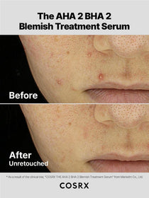 COSRX The AHA 2 BHA 2 Blemish Treatment Serum - 50g — official product gallery image 3
