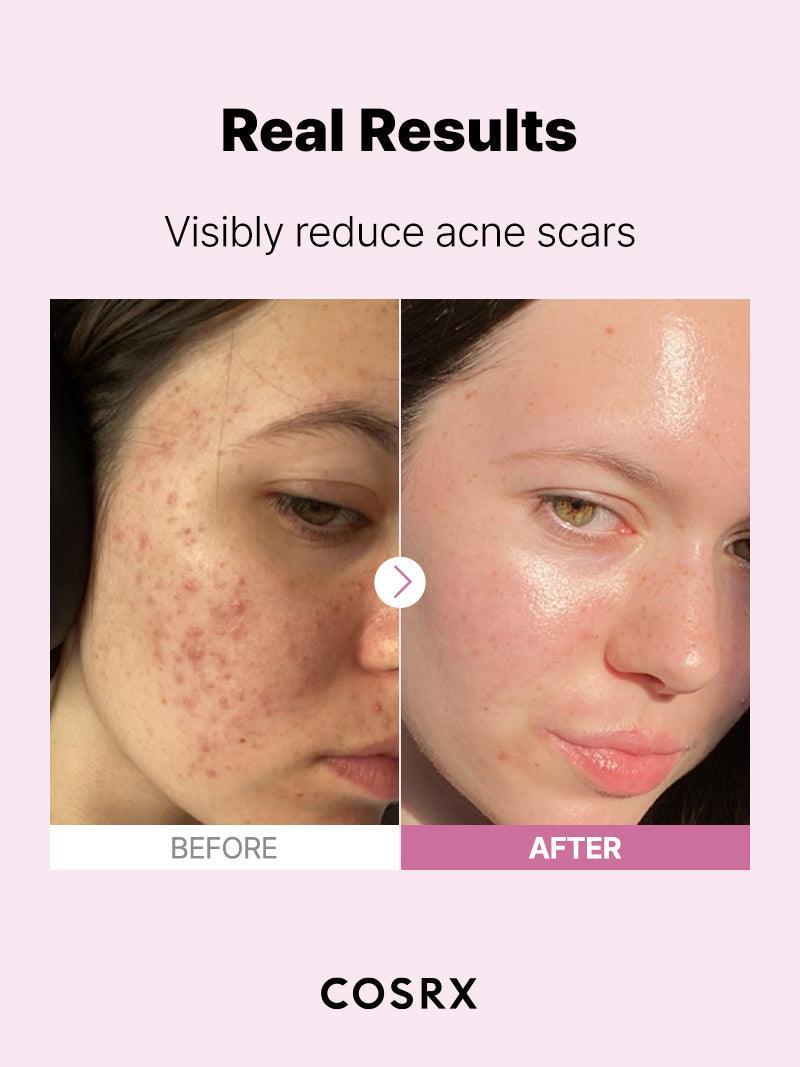 COSRX The Niacinamide 15 Serum - 20ml — official product gallery image 8