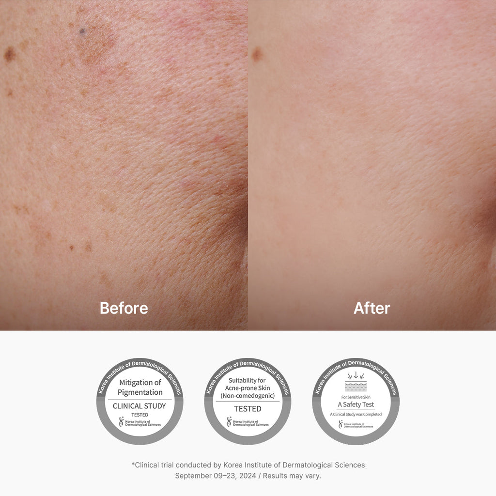 Dr.Althea Vitamin C Boosting Serum - 30ml — official product gallery image 5