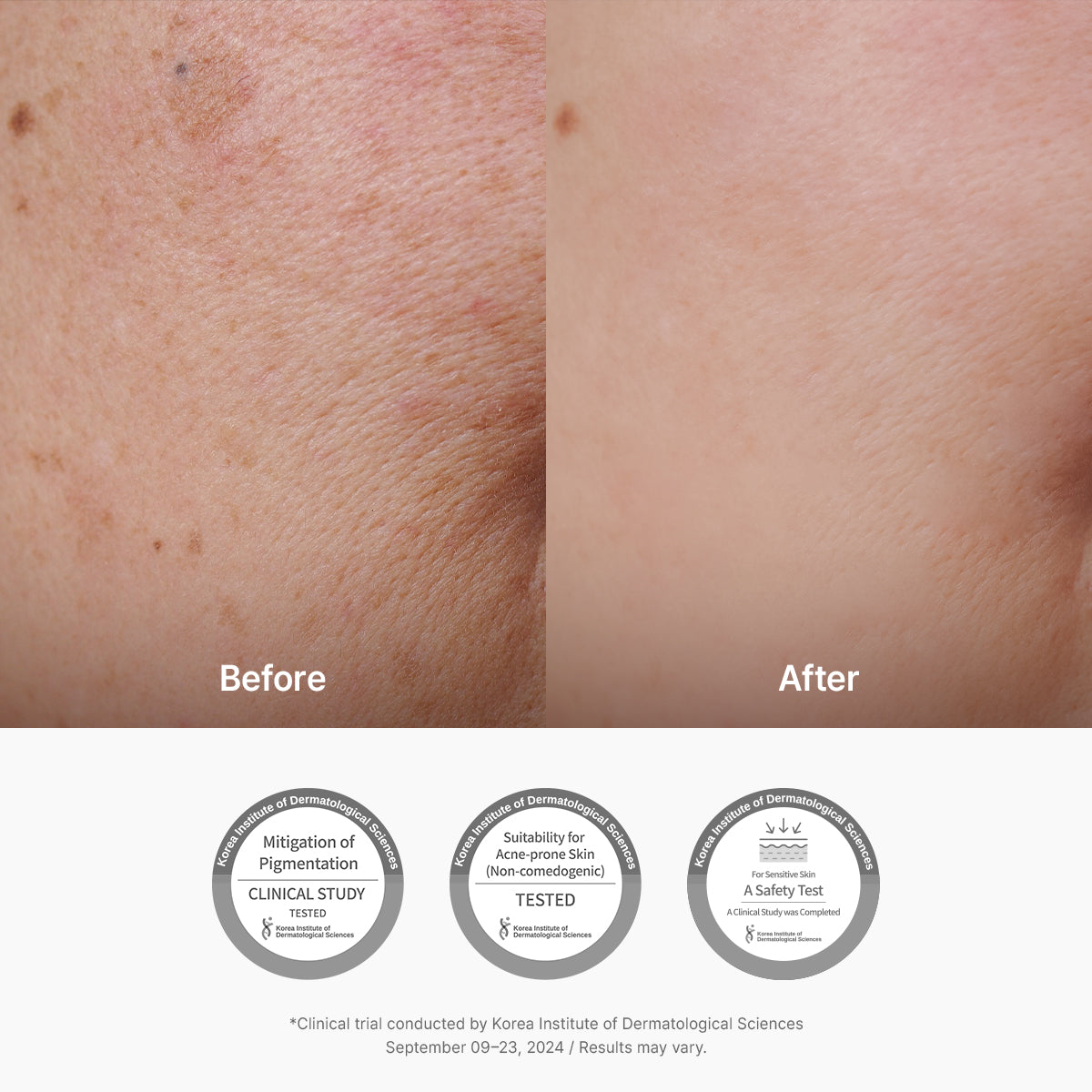 Dr.Althea Vitamin C Boosting Serum - 30ml — official product gallery image 5