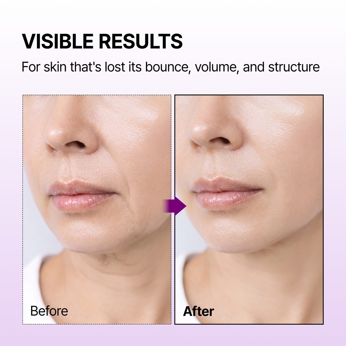 Dr. Melaxin Calcium Bonding Serum — official product gallery image 3