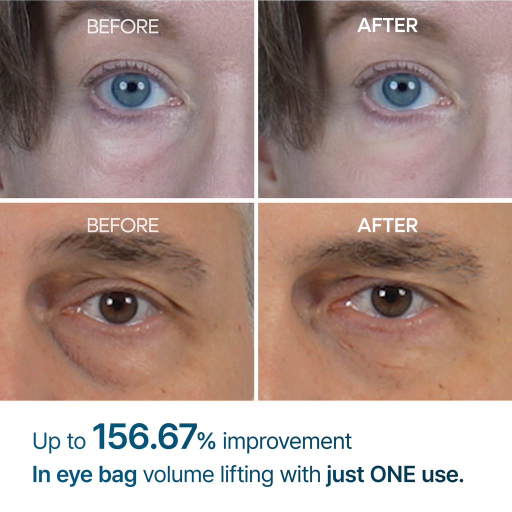 Dr. Melaxin Eyephalt Eyebag Cream — official product gallery image 3