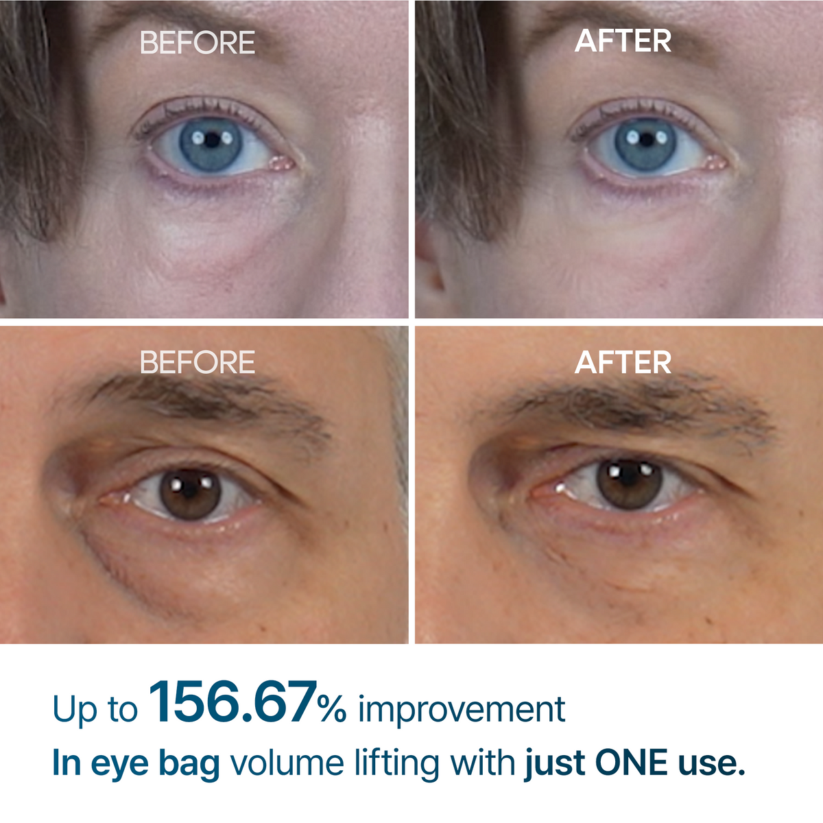 Dr. Melaxin Eyephalt Eyebag Cream — official product gallery image 3