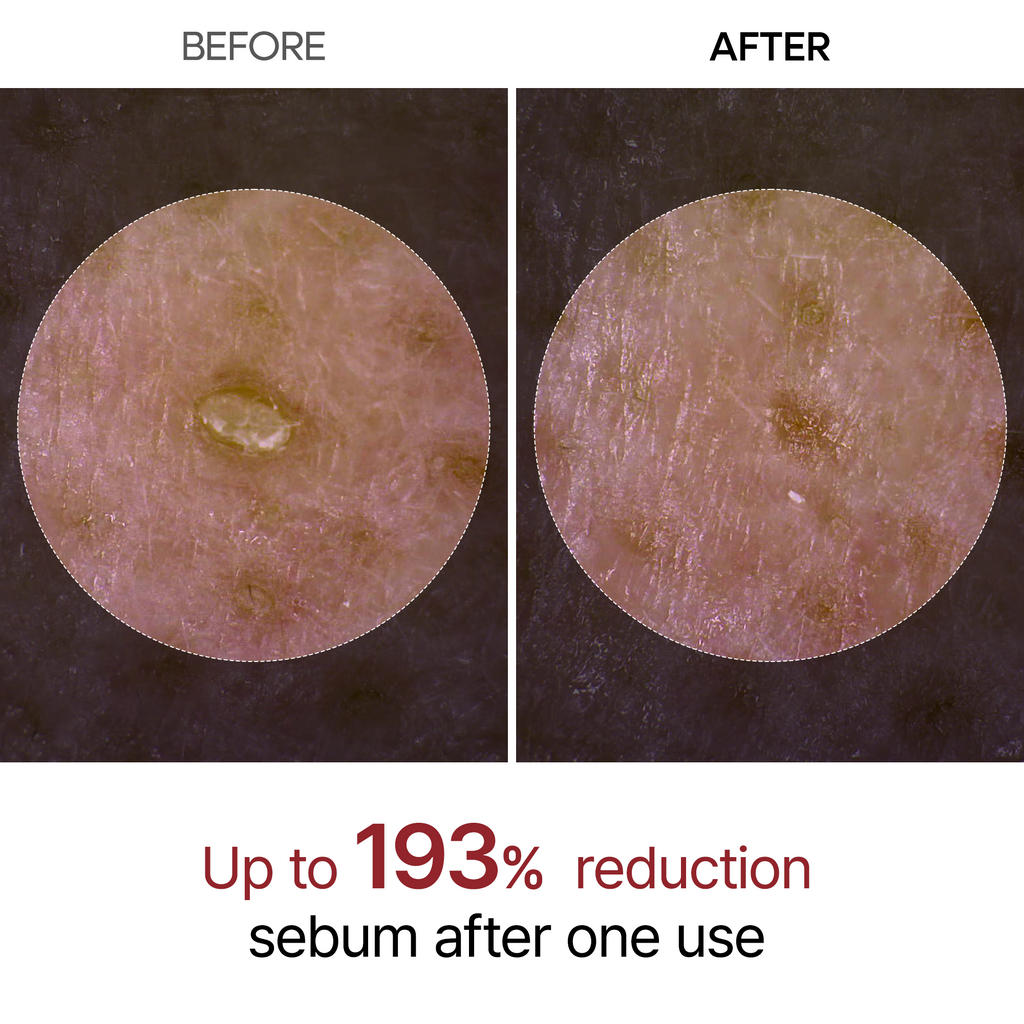 Dr. Melaxin Peel Shot Glow Black Rice Ampoule — official product gallery image 4