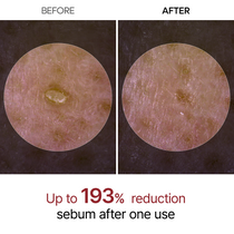 Dr. Melaxin Peel Shot Glow Black Rice Ampoule — official product gallery image 4