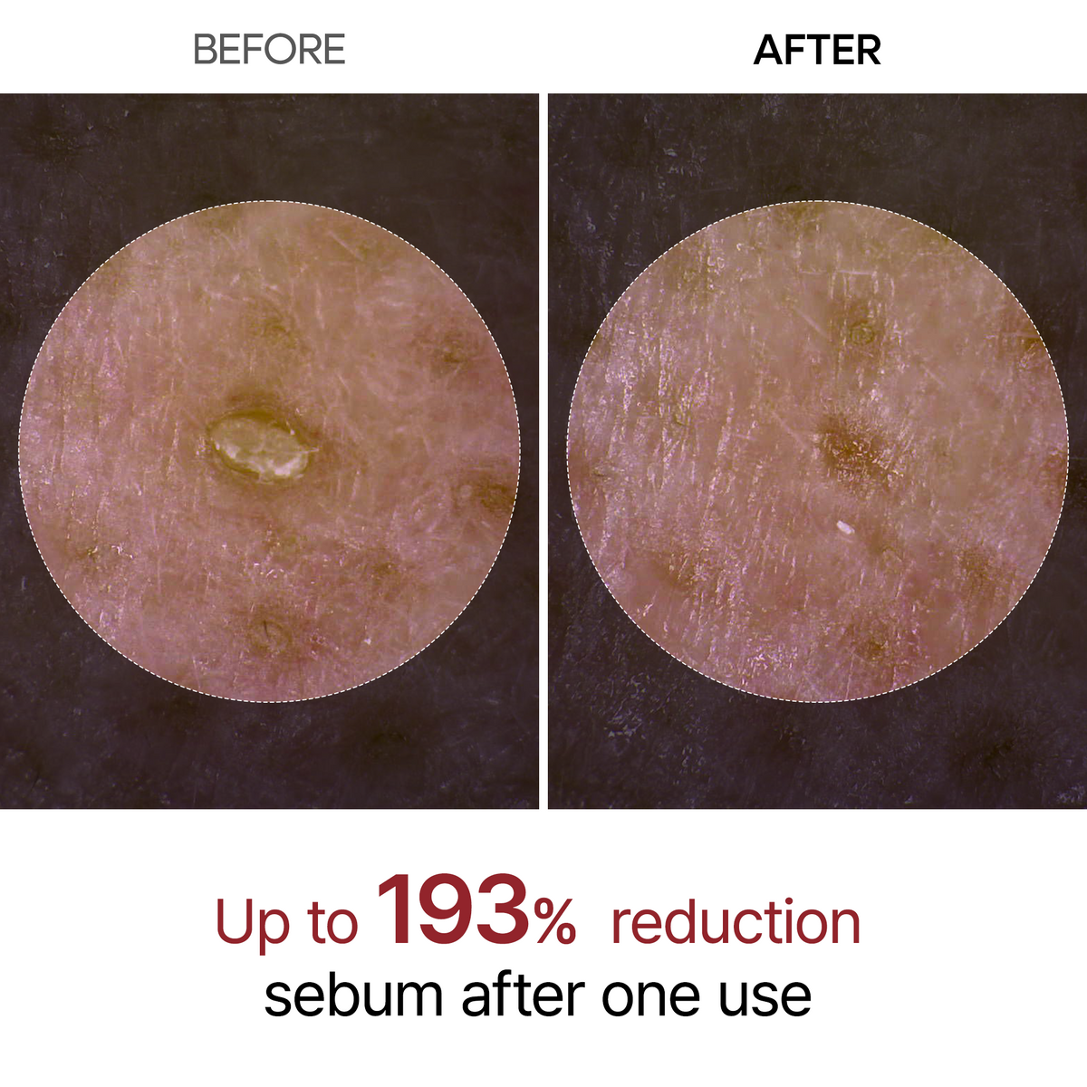 Dr. Melaxin Peel Shot Glow Black Rice Ampoule — official product gallery image 4