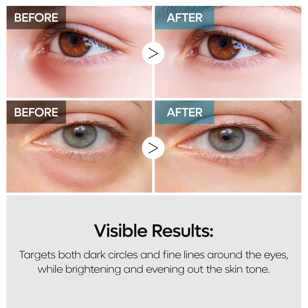 Dr. Melaxin TX Retinalsome Double Effect Eye Cream — official product gallery image 6