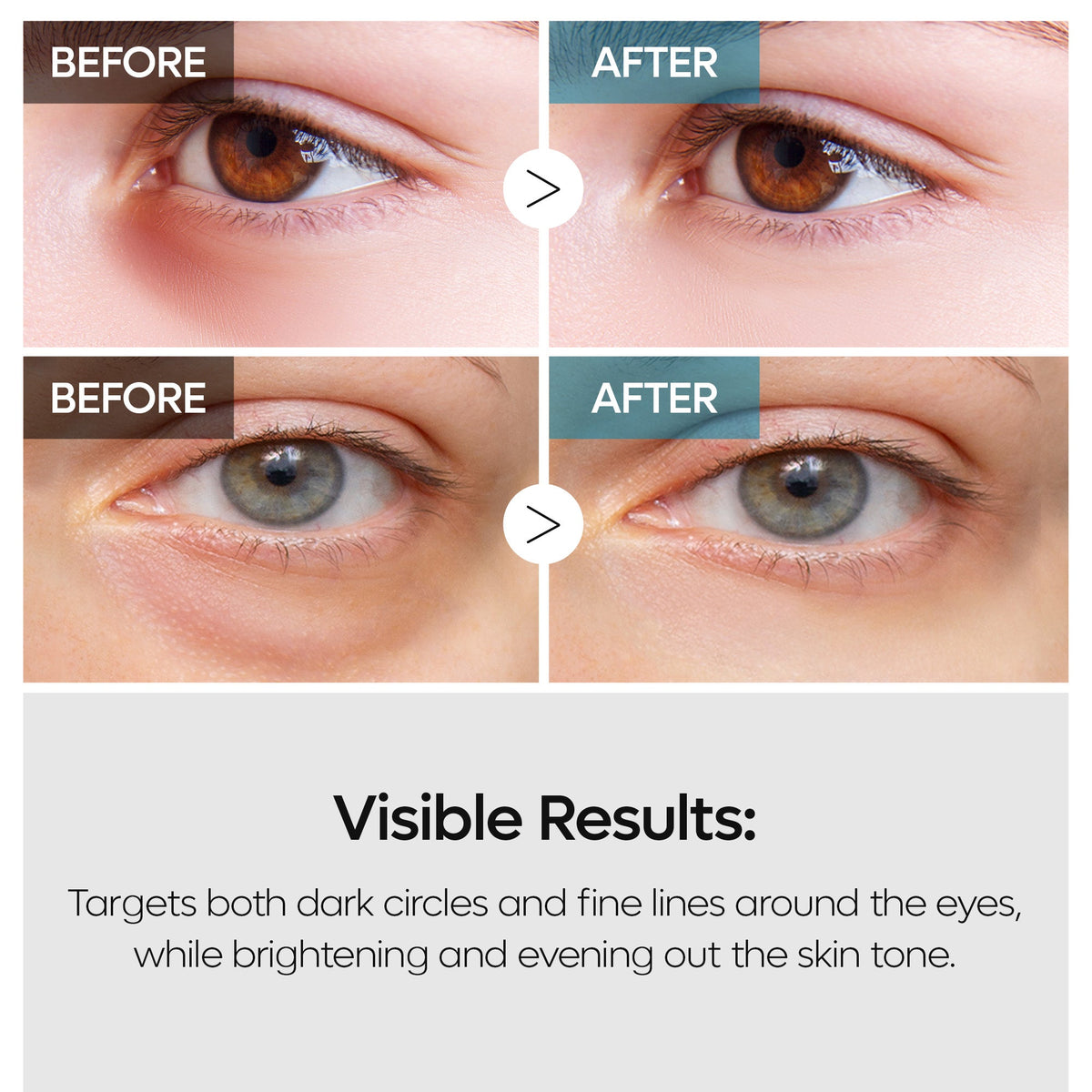 Dr. Melaxin TX Retinalsome Double Effect Eye Cream — official product gallery image 6
