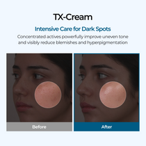 Dr. Melaxin TX Tranexamic Acid Cream — official product gallery image 3
