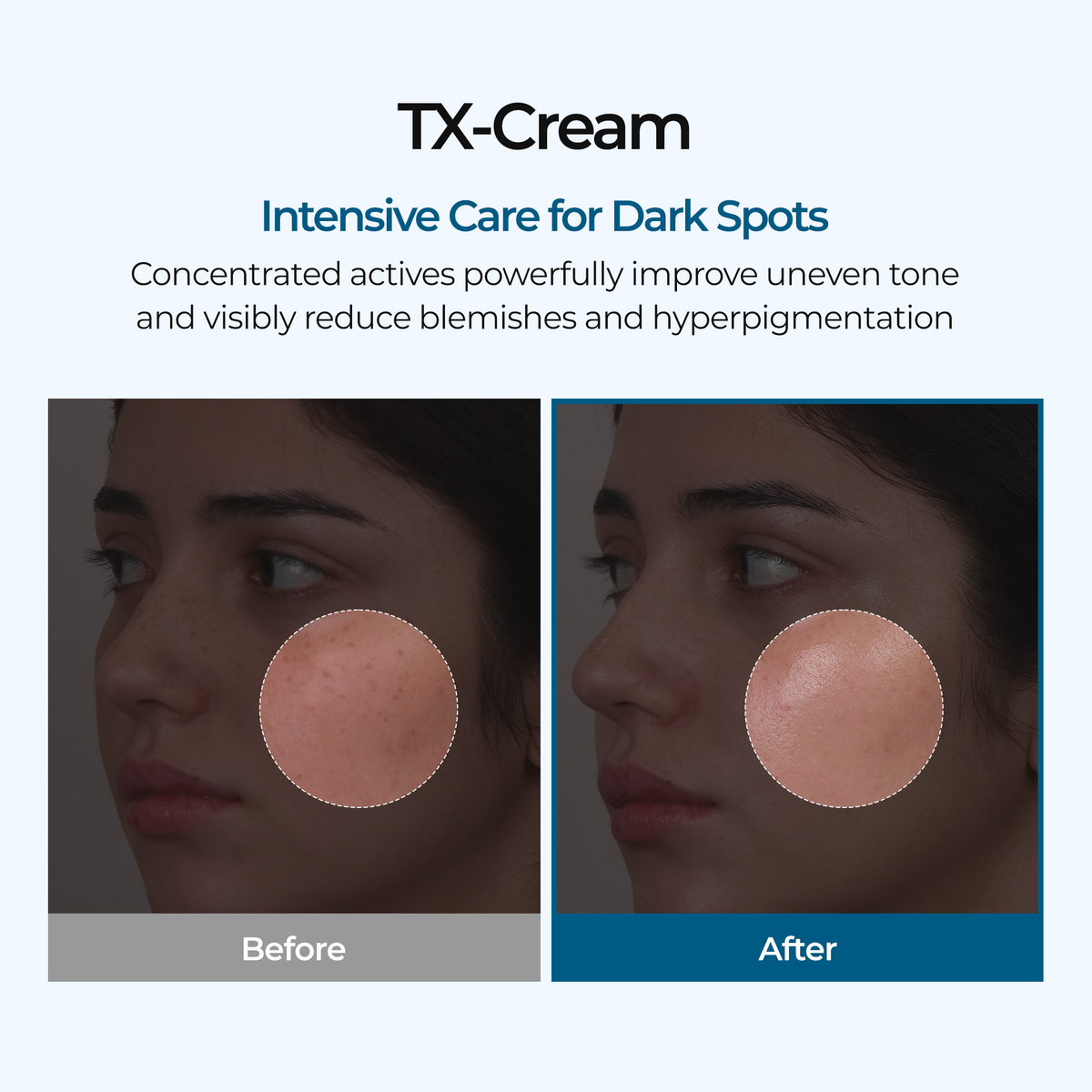 Dr. Melaxin TX Tranexamic Acid Cream — official product gallery image 3