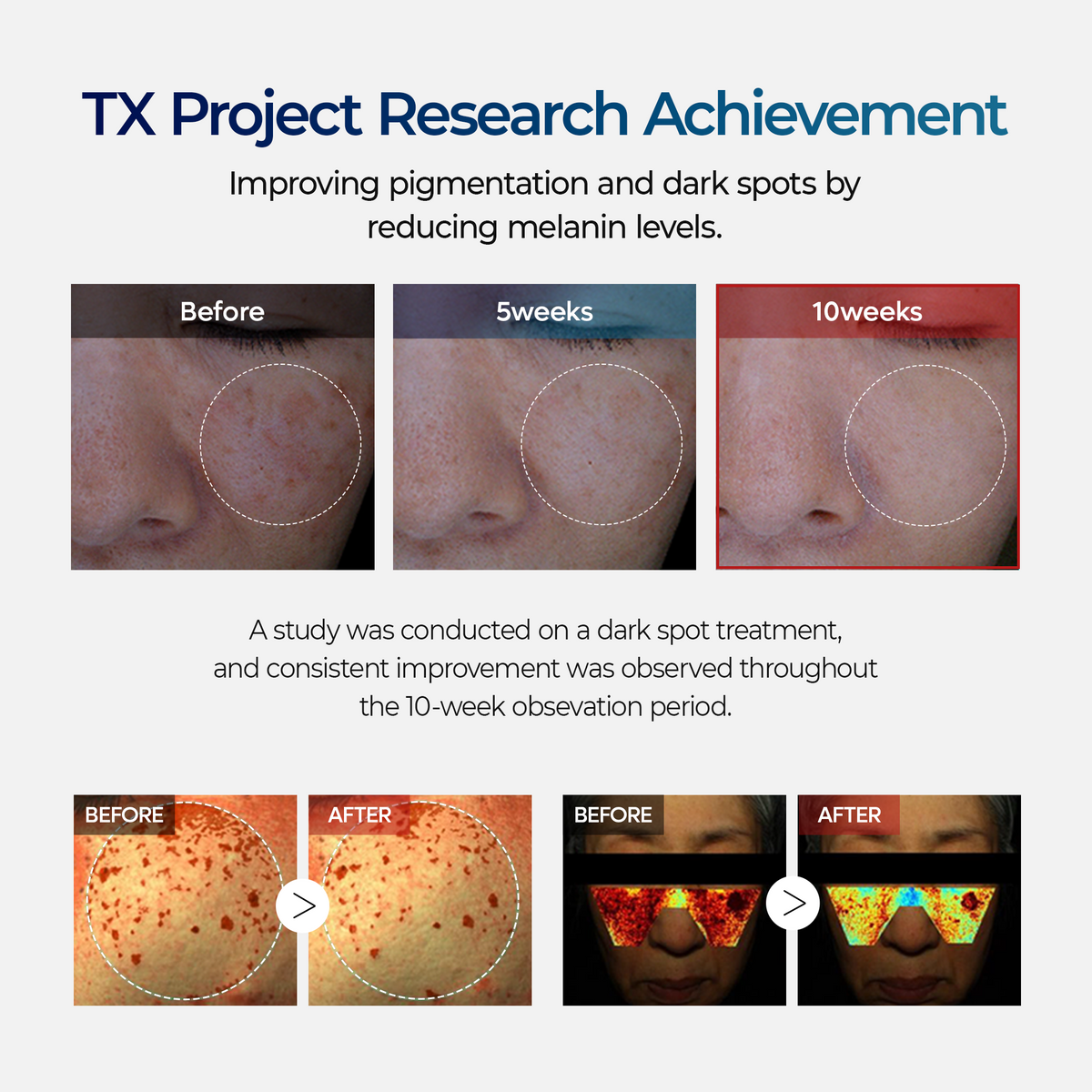 Dr. Melaxin TX Tranexamic Acid Cream — official product gallery image 7